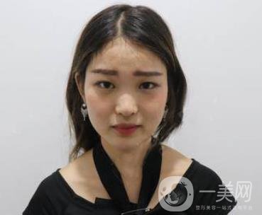 西安華旗唯美整形醫(yī)院做*多少錢？?jī)r(jià)格表收費(fèi)明細(xì)和案例分享