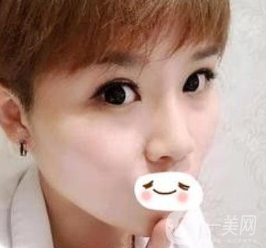 四川省人民醫(yī)院整形科駝峰鼻矯正多少錢？?jī)r(jià)格表2020更新