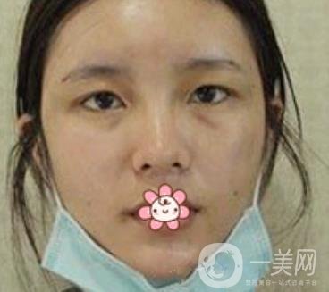 襄陽中心醫(yī)院整形美容科價(jià)格表2020版出爐，附雙眼皮日記