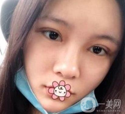 襄陽中心醫(yī)院整形美容科價(jià)格表2020版出爐，附雙眼皮日記