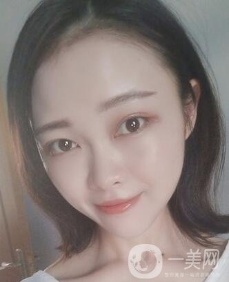 徐州亞韓整形醫(yī)院價格表費用明細，附面部除皺日記展示