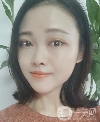 徐州亞韓整形醫(yī)院價格表費用明細，附面部除皺日記展示