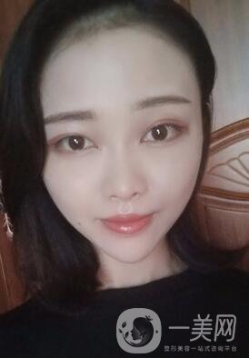 徐州亞韓整形醫(yī)院價格表費用明細，附面部除皺日記展示