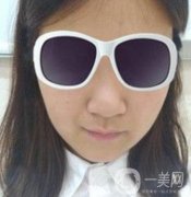 北京亞楠容悅醫(yī)療美容鼻部手術(shù)果靠譜嗎?2020年價(jià)格明細(xì)一覽表