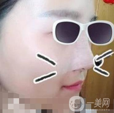 北京亞楠容悅醫(yī)療美容**果靠譜嗎?2020年價格明細一覽表