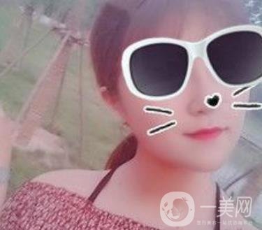 北京亞楠容悅醫(yī)療美容**果靠譜嗎?2020年價格明細一覽表
