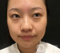 北京知音醫(yī)療美容熱瑪吉果怎么樣？貴嗎？收費(fèi)價(jià)格表2020公布