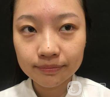 北京知音醫(yī)療美容熱瑪吉*果怎么樣？貴嗎？收費(fèi)價(jià)格表2020公布