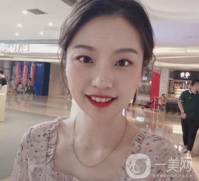北京知音醫(yī)療美容熱瑪吉*果怎么樣？貴嗎？收費(fèi)價(jià)格表2020公布