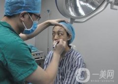 成都美容整形醫(yī)院做脂肪填充全臉果靠譜嗎?近期價(jià)格表和案例參考