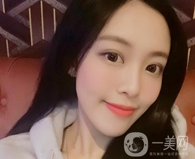 成都美容整形醫(yī)院做脂肪填充全臉*果靠譜嗎?近期價格表和案例參考