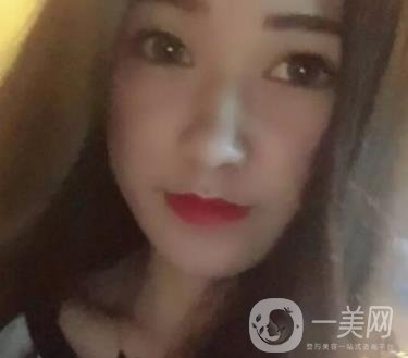 徐州第一人民醫(yī)院整形科價(jià)格表，含激光祛疤*果
