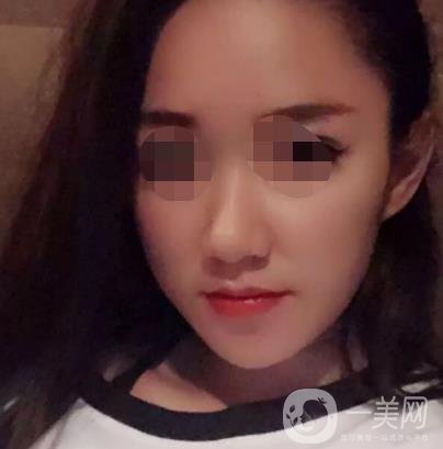 徐州第一人民醫(yī)院整形科價(jià)格表，含激光祛疤*果