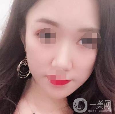 徐州第一人民醫(yī)院整形科價(jià)格表，含激光祛疤*果