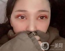 恩施州中心醫(yī)院美容整形科怎么樣？價格表和雙眼皮整形經(jīng)歷分享