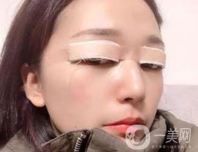恩施州中心醫(yī)院美容整形科怎么樣？價(jià)格表和雙眼皮整形經(jīng)歷分享