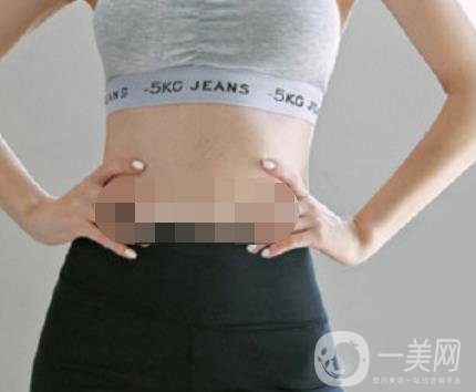 汾陽醫(yī)院美容整形科祛妊娠紋怎么樣？手術(shù)項(xiàng)目收費(fèi)價(jià)格表和案例一覽