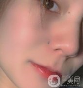 黃岡市中心醫(yī)院美容整形科祛痣多少錢？價格費(fèi)用表和果圖精選