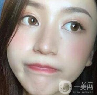 荊州市第三人民醫(yī)院整形美容科*祛斑*果好嗎？收費(fèi)價(jià)格明細(xì)表一覽