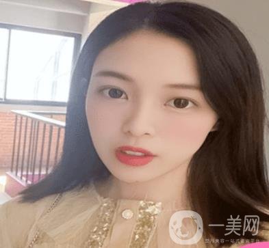 贛州附屬醫(yī)院整形美容科價(jià)格表及點(diǎn)痣案例公布，速覽