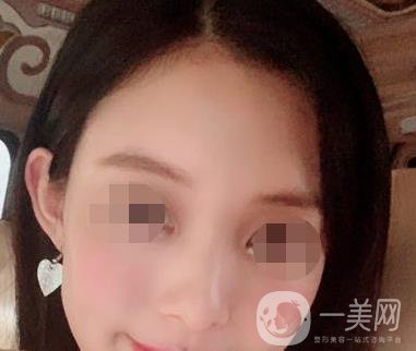 贛州附屬醫(yī)院整形美容科價(jià)格表及點(diǎn)痣案例公布，速覽