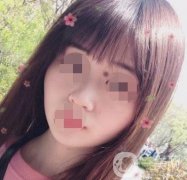 贛州附屬醫(yī)院整形美容科價格表及點(diǎn)痣案例公布，速覽