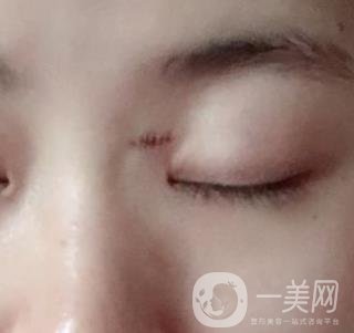 贛州附屬醫(yī)院整形美容科價(jià)格表及點(diǎn)痣案例公布，速覽