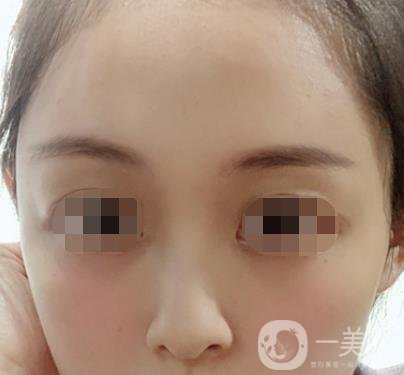 贛州附屬醫(yī)院整形美容科價(jià)格表及點(diǎn)痣案例公布，速覽