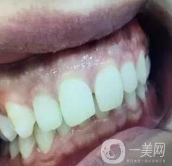 龍崗中心醫(yī)院整牙多少錢？?jī)r(jià)格表2020收費(fèi)明細(xì)公開一覽