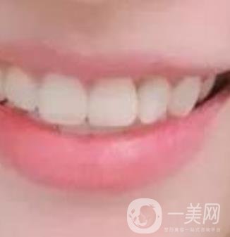 龍崗中心醫(yī)院整牙多少錢？?jī)r(jià)格表2020收費(fèi)明細(xì)公開一覽
