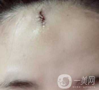 南昌二附院整形美容科價(jià)格表及祛痣日志公開，速覽