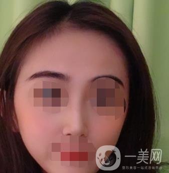 南昌二附院整形美容科價(jià)格表及祛痣日志公開，速覽