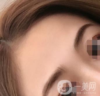南昌二附院整形美容科價(jià)格表及祛痣日志公開，速覽