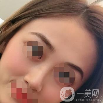 南昌二附院整形美容科價(jià)格表及祛痣日志公開，速覽