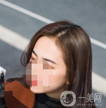 南昌二附院整形美容科價(jià)格表及祛痣日志公開，速覽