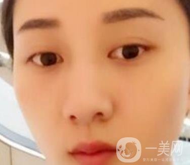 安醫(yī)一附院整形外科價(jià)格表2020版，還有激光祛斑案例