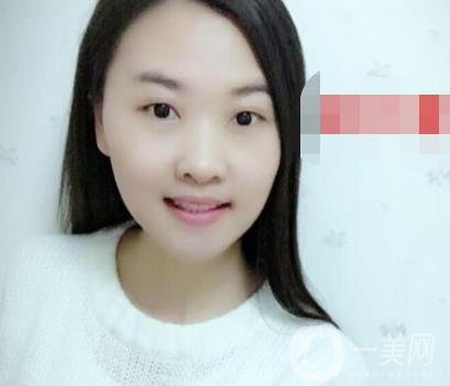 北京市海淀醫(yī)院口腔科價格表2020更新，附牙齒矯正案例