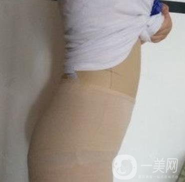 襄陽(yáng)市第一人民醫(yī)院整形美容科吸脂瘦肚子多少錢(qián)？?jī)r(jià)格表整形日記一覽
