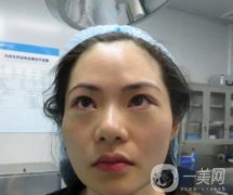 廣州南方醫(yī)院去眼袋費(fèi)用多少？2020整形價格表一覽