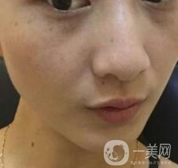 青醫(yī)附院整形美容科價(jià)格表及祛斑案例公布，速覽