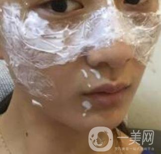 青醫(yī)附院整形美容科價(jià)格表及祛斑案例公布，速覽