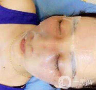 青醫(yī)附院整形美容科價(jià)格表及祛斑案例公布，速覽
