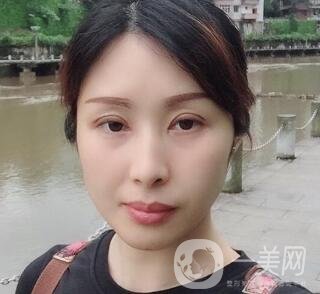 沈陽(yáng)軍區(qū)總醫(yī)院整形外科價(jià)格表，附雙眼皮真實(shí)案例