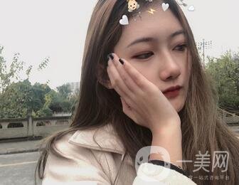 重慶新橋醫(yī)院整形科價格表，隆鼻案例分享