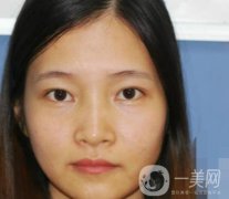 北京朝陽醫(yī)院整形中心紋眉果怎么樣？價格價目表詳情一覽