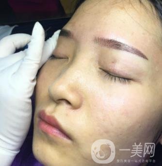 北京朝陽醫(yī)院整形中心紋眉*果怎么樣？價(jià)格價(jià)目表詳情一覽