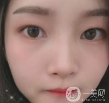 北京朝陽醫(yī)院整形中心紋眉*果怎么樣？價(jià)格價(jià)目表詳情一覽