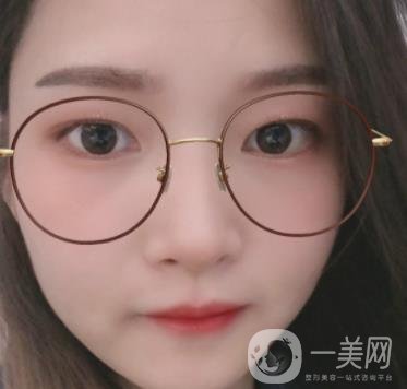 北京朝陽醫(yī)院整形中心紋眉*果怎么樣？價(jià)格價(jià)目表詳情一覽