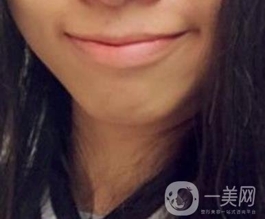 復(fù)旦大學(xué)附屬兒科醫(yī)院口腔科做牙齒矯正多少錢？?jī)r(jià)格表明細(xì)一覽