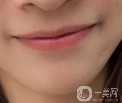 復(fù)旦大學(xué)附屬兒科醫(yī)院口腔科做牙齒矯正多少錢？?jī)r(jià)格表明細(xì)一覽